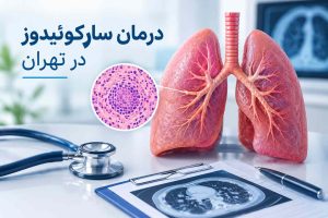 درمان سارکوئیدوز در تهران